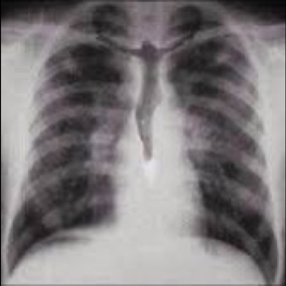 Meet your Posher, Aaron - Picture 1 of 1